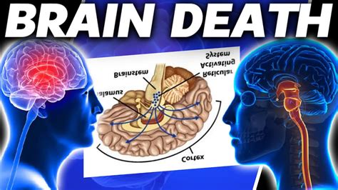 bain stem|brain stem death.